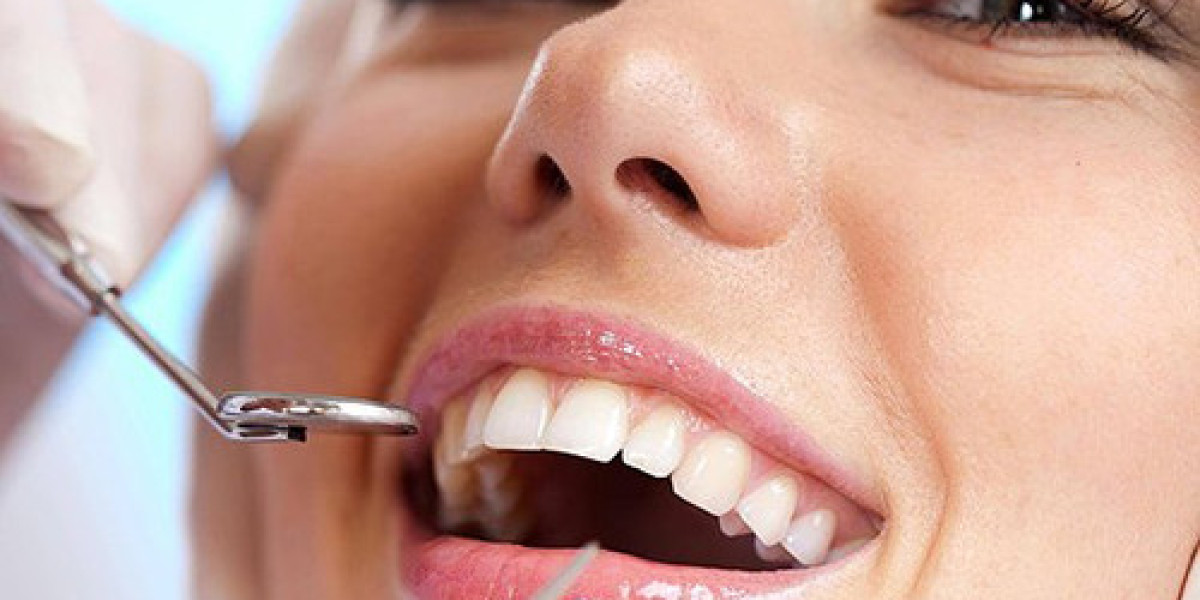 Permanent Dentures in Tampa: A Complete Guide to Benefits, Procedure, and Aftercare