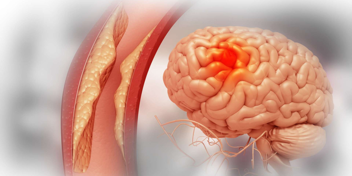 Unlock New Insights in Stroke Research with Behavioral Tests
