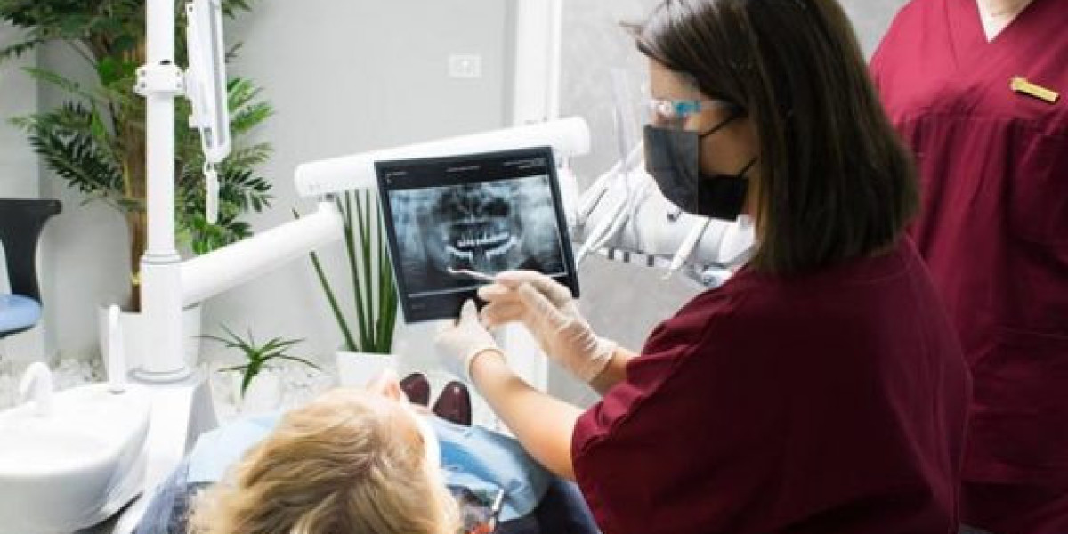 Discover the Benefits of Choosing All-on‑4 Dental Implants in Albania